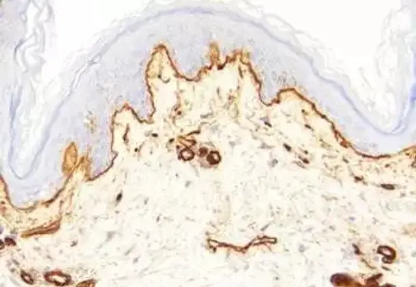 PMPA (NAALADase inhibitor) - 5mg